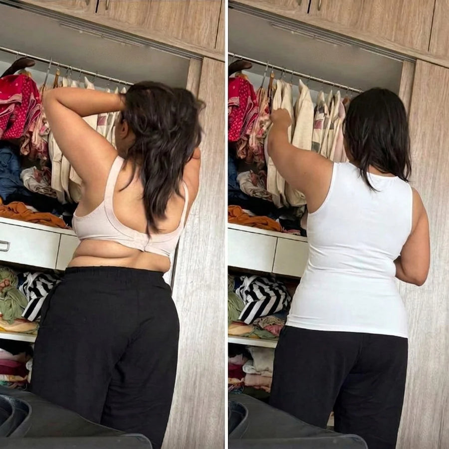 Susana D. — antes y después
